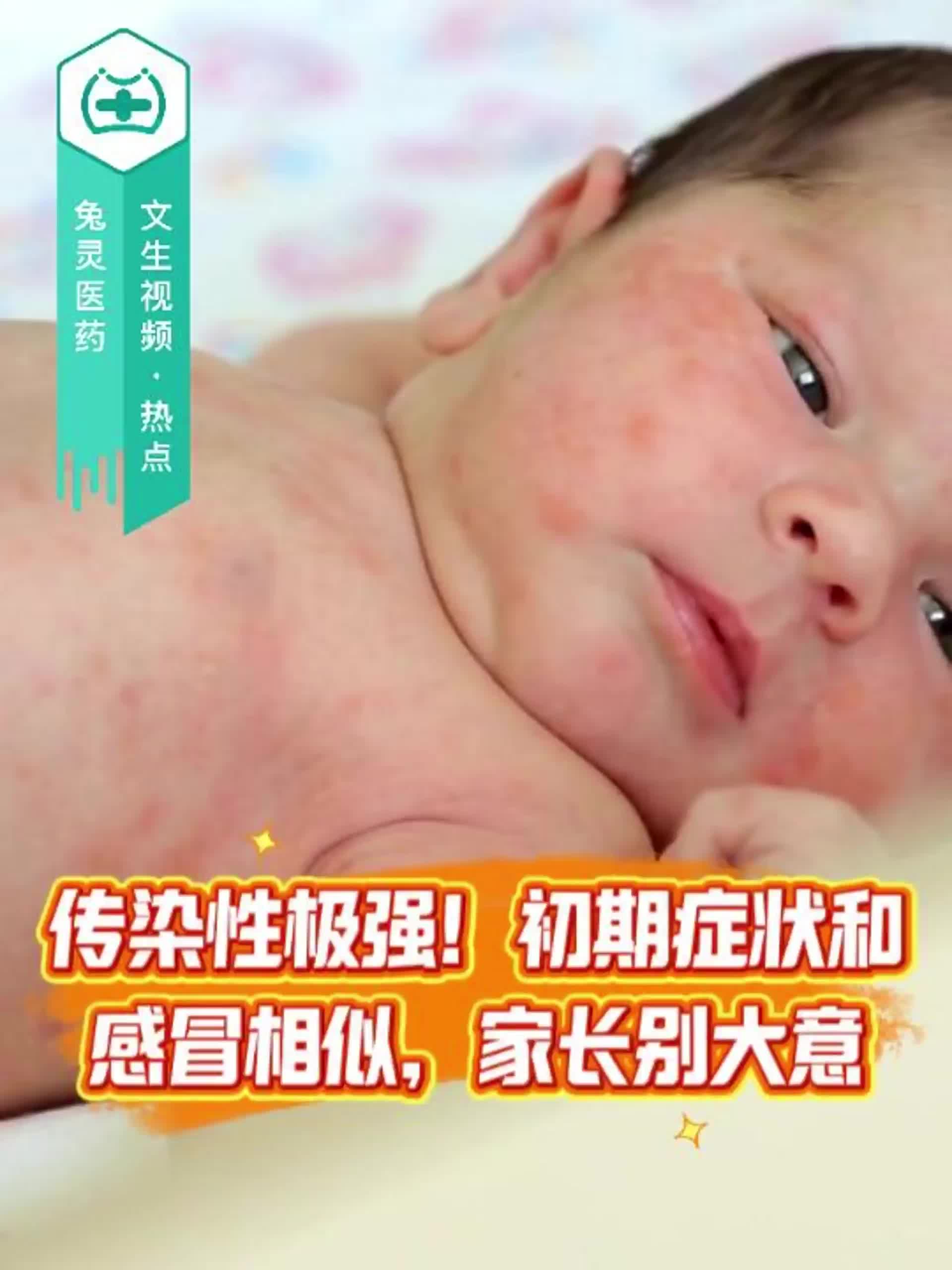 传染性极强！初期症状和感冒相似，家长别大意！