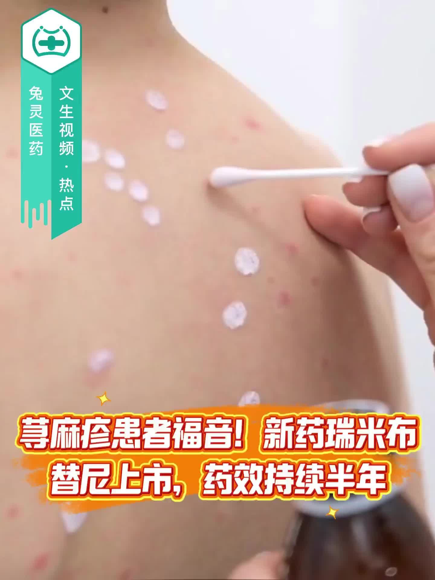 荨麻疹患者福音！新药瑞米布替尼上市，药效持续半年！