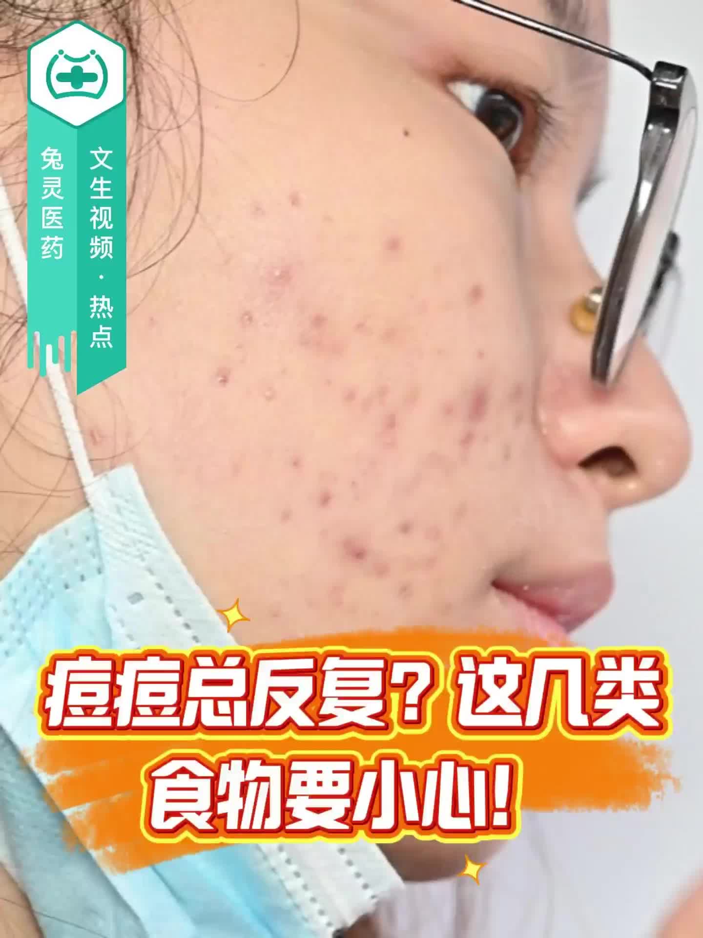 痘痘总反复？这几类食物要小心！