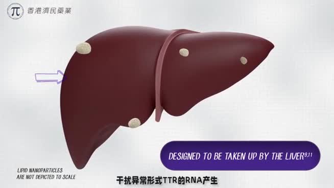 新药Patisiran 或可用于治疗成人hATTR淀粉样变性多神经病