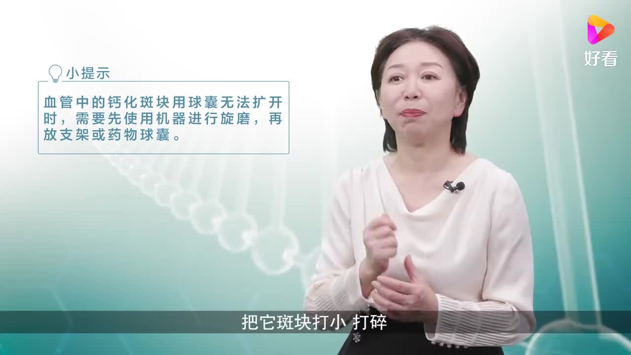 网传可用仪器把动脉粥样硬化斑块磨掉是真的吗?