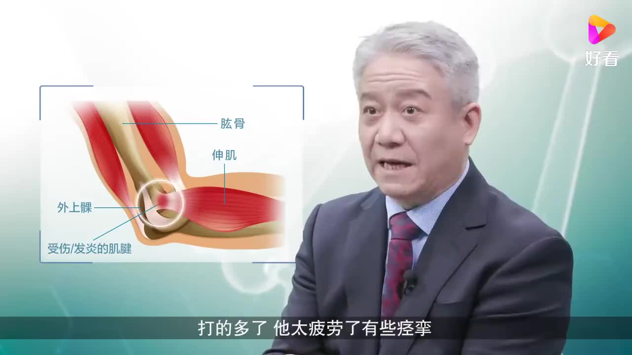 网球肘该怎么治疗?