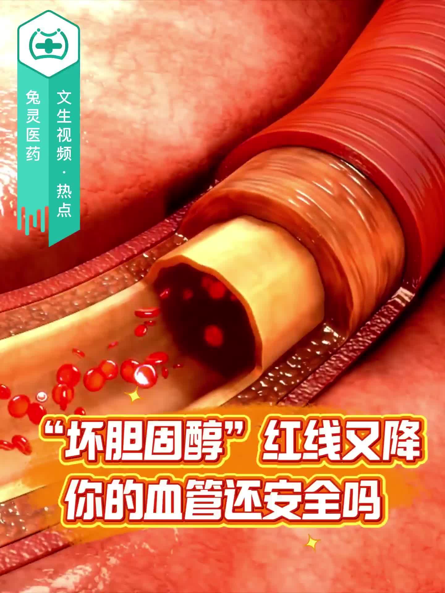 “坏胆固醇”红线又降！你的血管还安全吗？